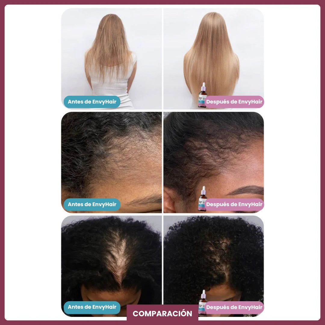 Envy Hair | Serum para el Crecimiento del Cabello