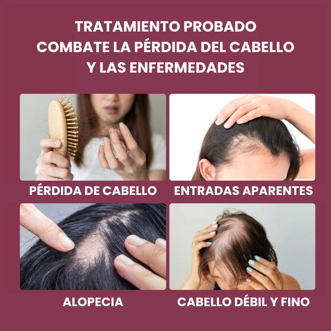 Envy Hair | Serum para el Crecimiento del Cabello