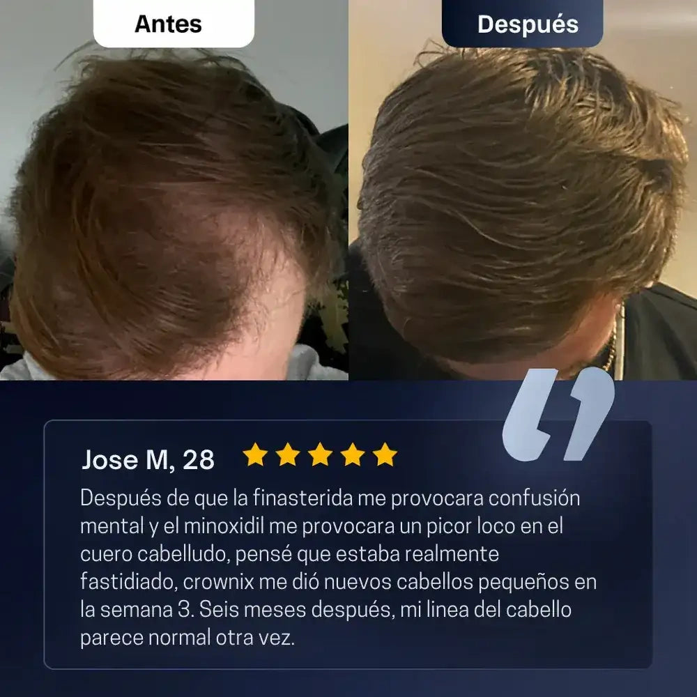 Roll On Crecimiento Capilar