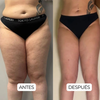 HORMONE HARMONY™ | ¿Cansancio, grasa abdominal y cambios de humor constantes?