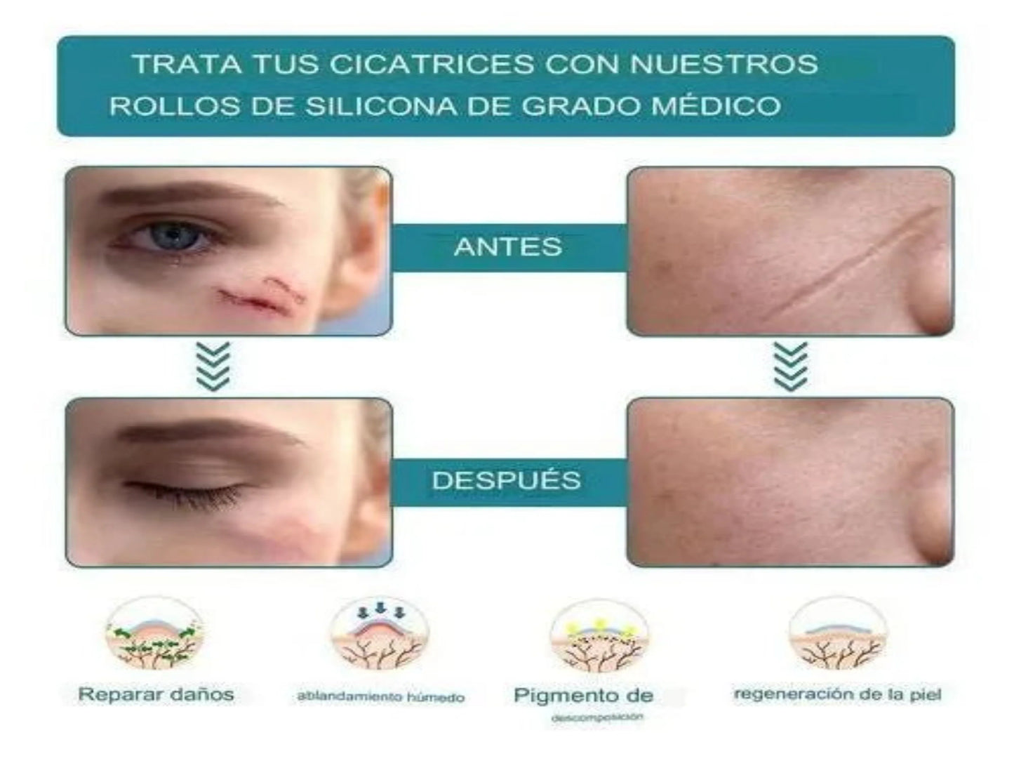 CINTA CICATRIZANTE