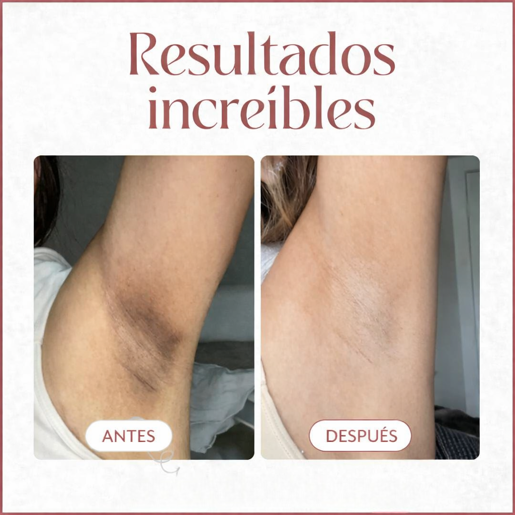CocoBeauty® | Elimina manchas en 14 días