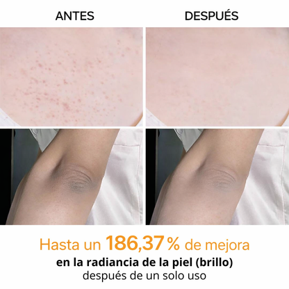 CocoBeauty® | Elimina manchas en 14 días