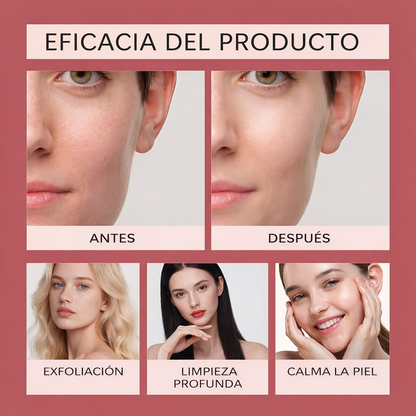 CocoBeauty® | Elimina manchas en 14 días