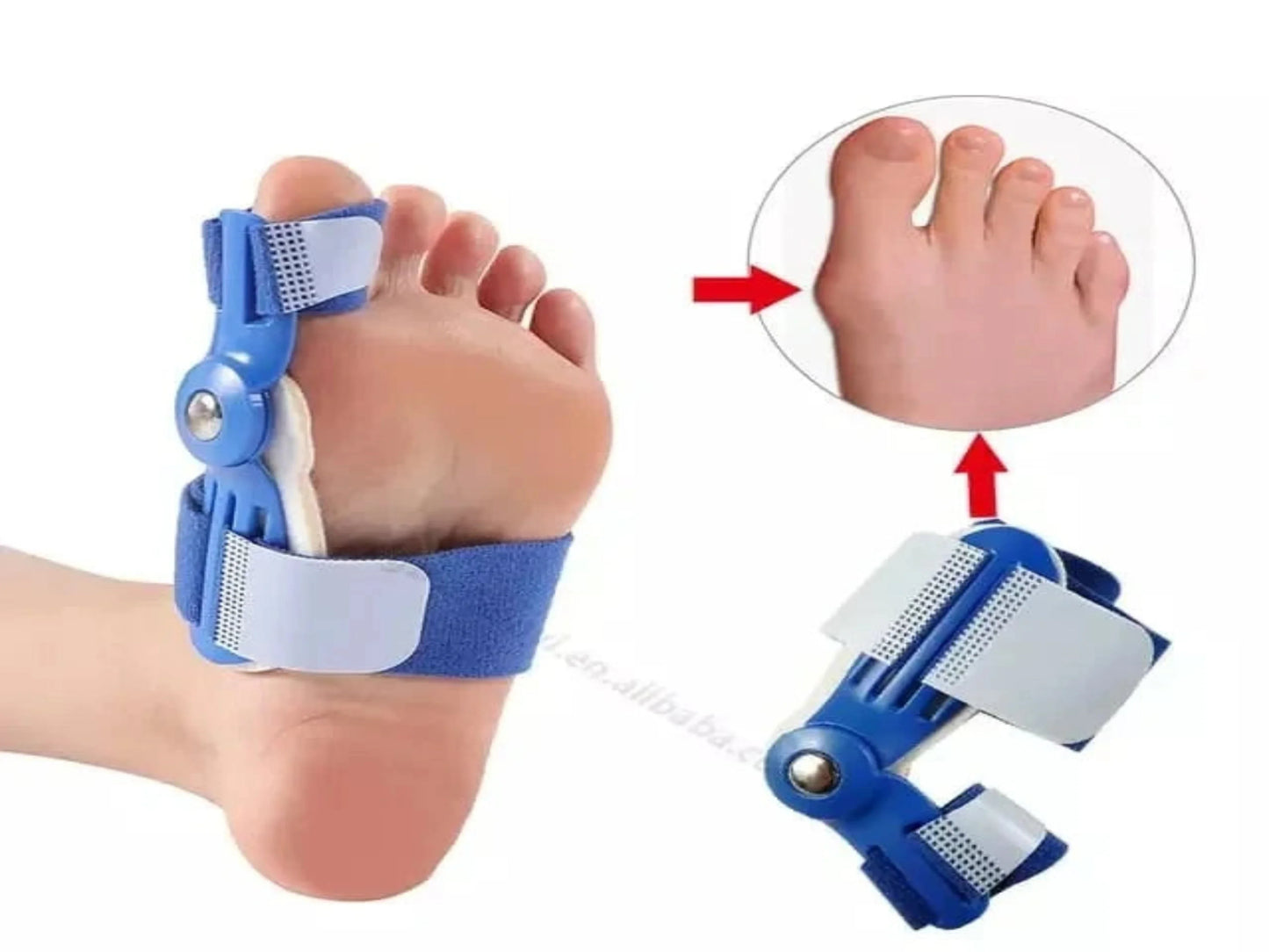 CORRECTOR DE JUANETES