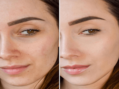 COVER UP - MAQUILLAJE ANTIEDAD