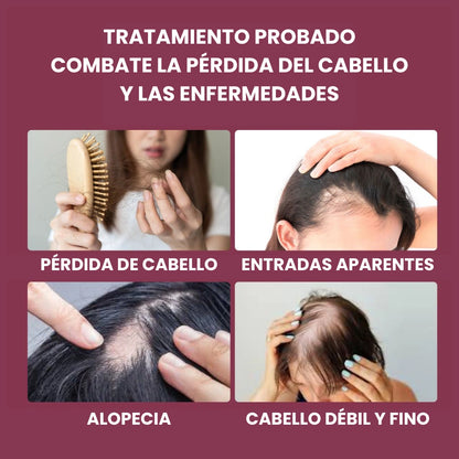 Envy Hair | Serum para el Crecimiento del Cabello