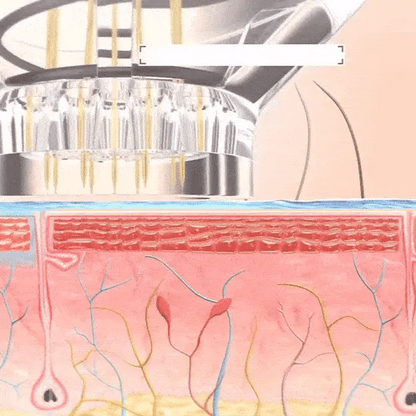 Serum Micro Infusión