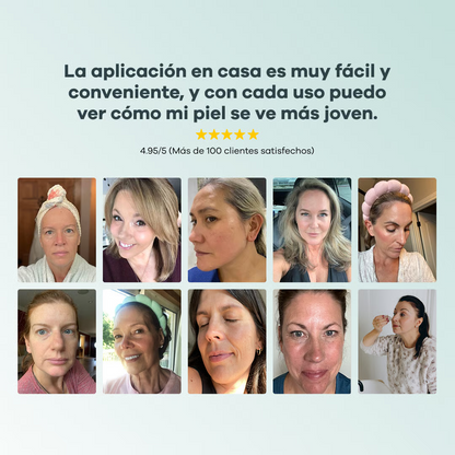Sistema de Infusión con Microneedling™