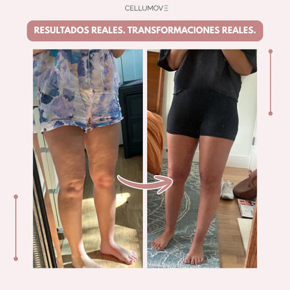 CELLUMOVE 3D – Despídete del dolor y la fatiga del lipedema de forma natural