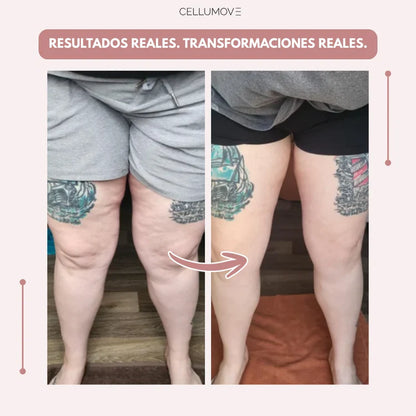 CELLUMOVE 3D – Despídete del dolor y la fatiga del lipedema de forma natural