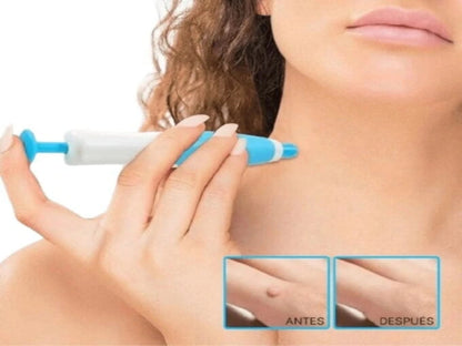 KIT QUITA VERRUGAS