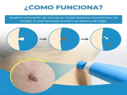 KIT QUITA VERRUGAS