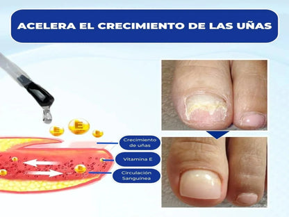SERUM DE UÑAS