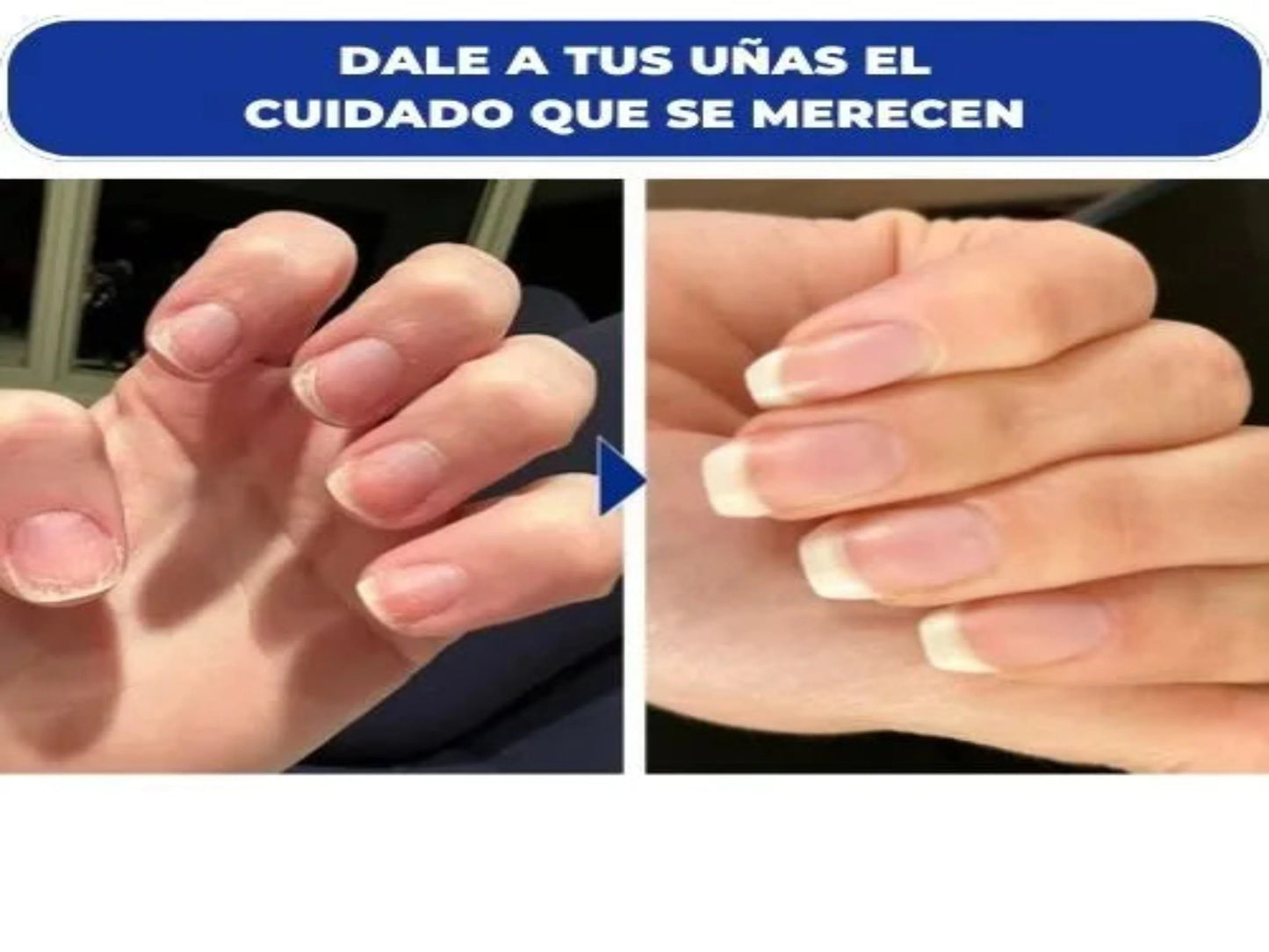 SERUM DE UÑAS