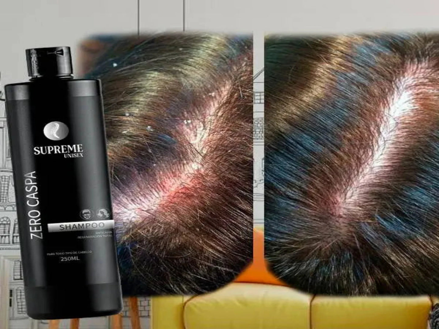 SHAMPOO ZERO CASPA